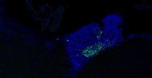 Células muertas (puntos verdes) en una de las zonas neurogénicas (en azul, todas las células) del cerebro de un ratón deficiente en Axl y Mer. En ratones normales no se observa ninguna señal verde./ Fuente: CSIC