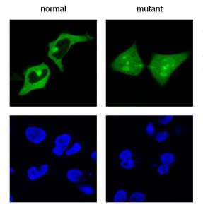 Una mutación del aminoácido 144 de la proteína UPSP21 (que cuenta con más de 500 aminoácidos) hace que esta proteína se acumule en el núcleo de una célula, en lugar de estar fuera. La imagen, obtenida mediante microscopía fluorescente, muestra la proteína en verde y el núcleo de la célula en azul / Foto: UPV/EHU